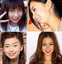 娱乐圈整容爆料,揭秘明星整形真相