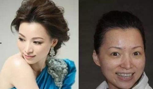 娱乐圈整容爆料,揭秘明星整形真相