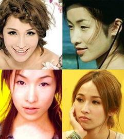 娱乐圈整容爆料,揭秘明星整形真相